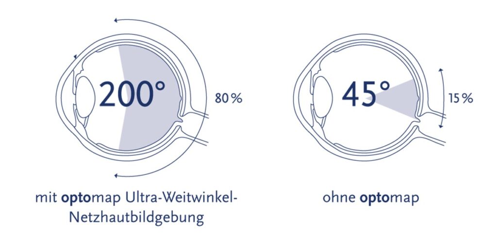 Optomap Aufname Winkel