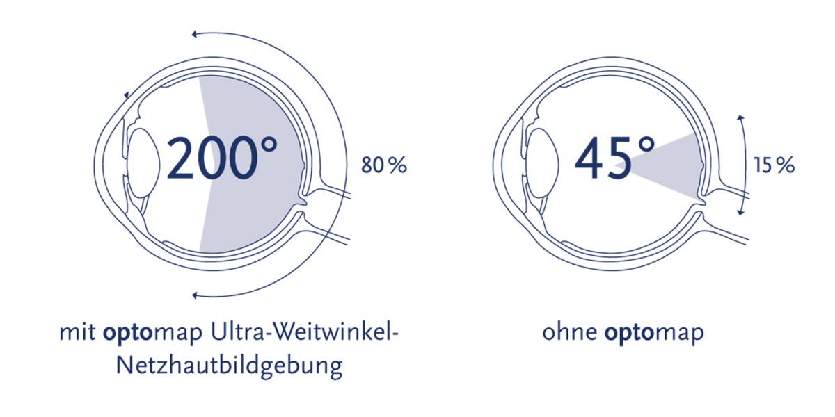 Optomap Aufname Winkel