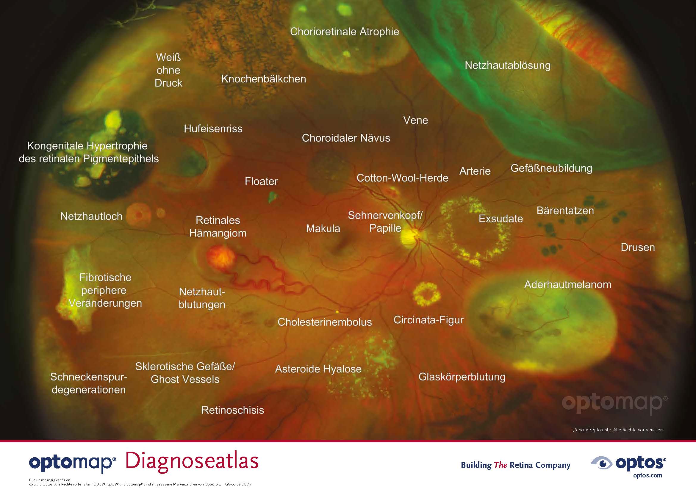 optomap farb diagnoseatlas de